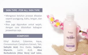 Acne Lotion Pratista – Mengatasi Jerawat Wajah / Punggung / Badan